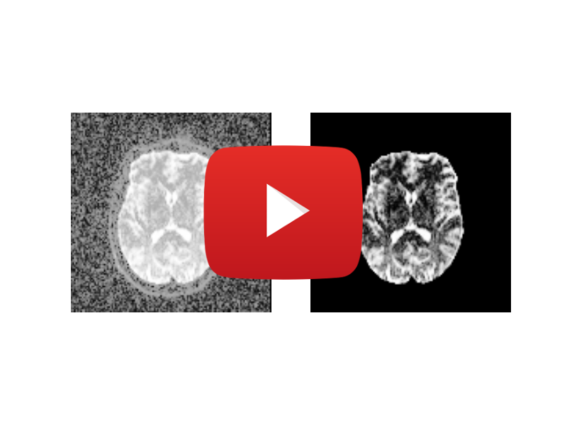 brain segmentation example